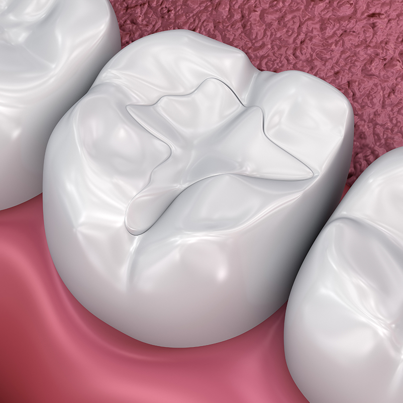 Treatment - Dental Solutions