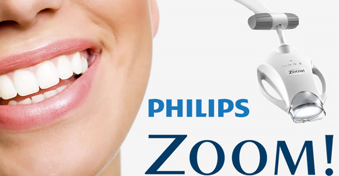 Zoom teeth whitening Warrington - Dental Solutions