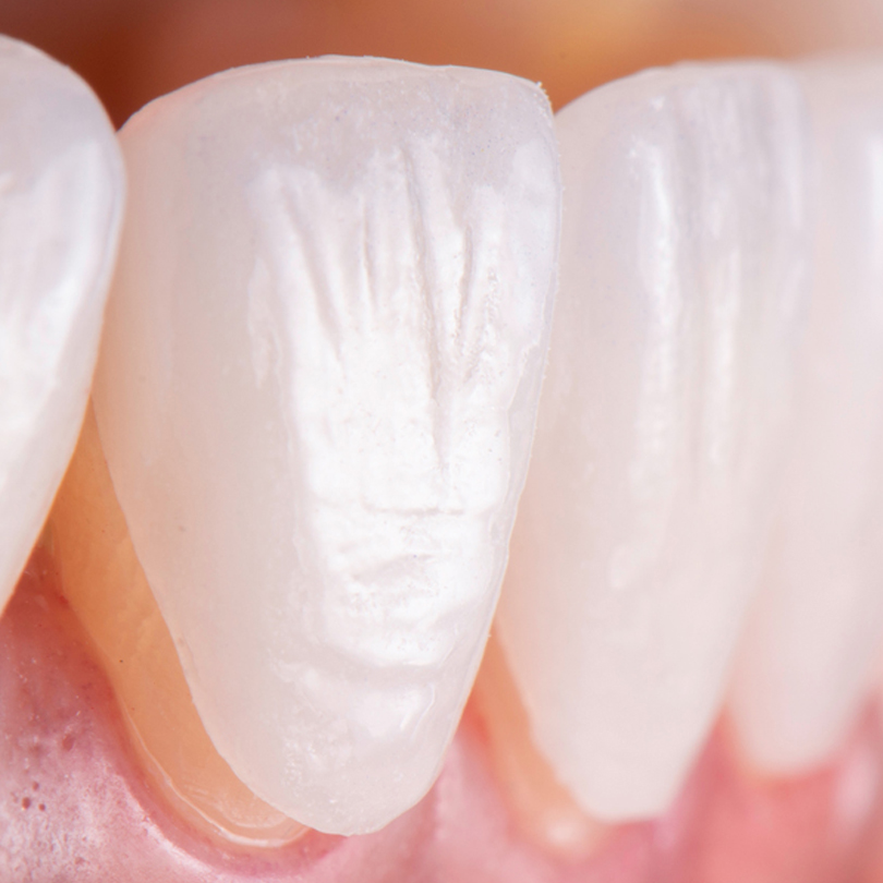 Treatment - Dental Solutions