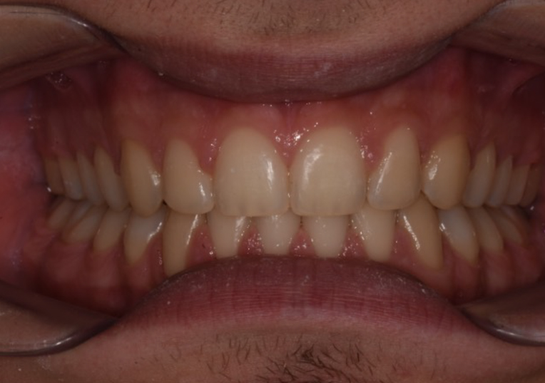 After - Dental Solutions