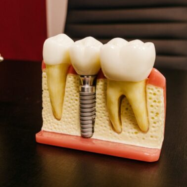 blog - Dental Solutions