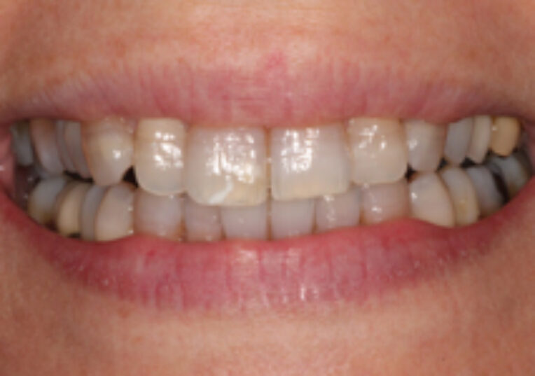 Before - Dental Solutions