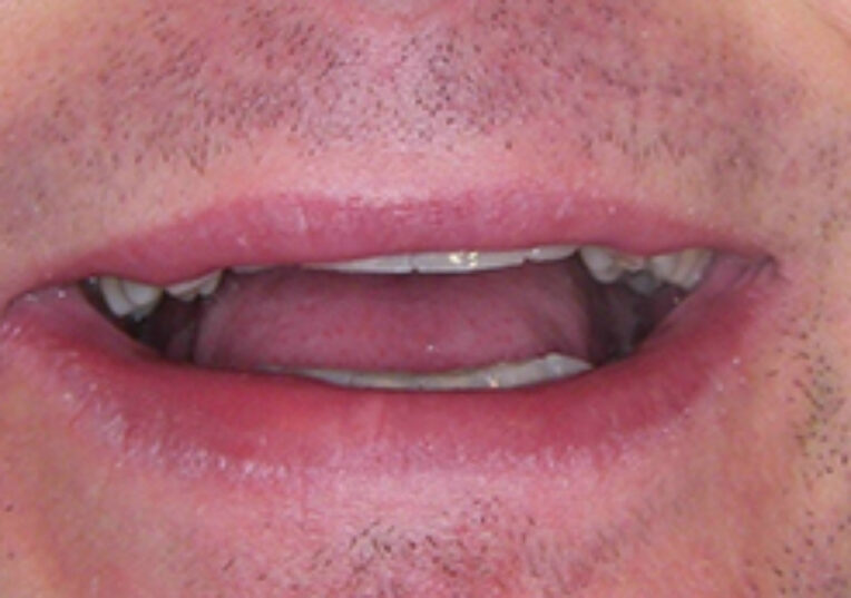 Before - Dental Solutions