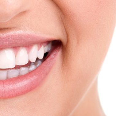 dental braces care